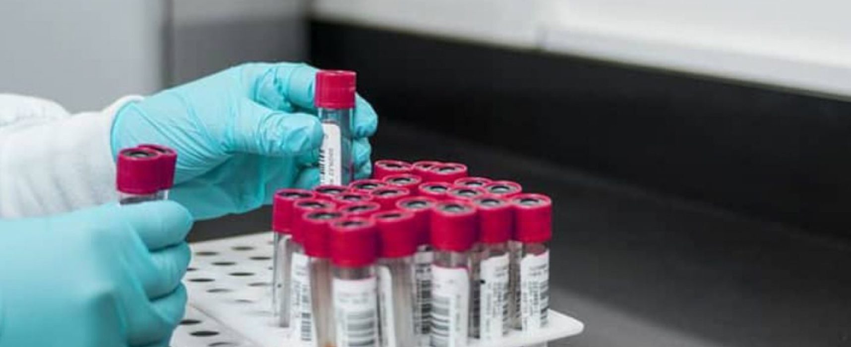 Coronavirus, aggiornamento odierno: 17 nuovi casi nella Bat, 49 il totale