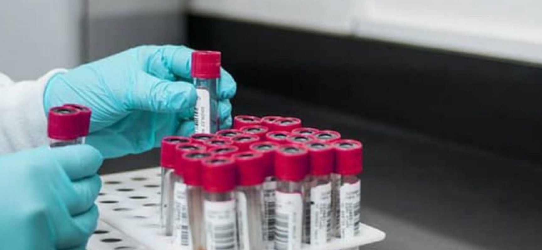 Coronavirus, aggiornamento odierno: 17 nuovi casi nella Bat, 49 il totale