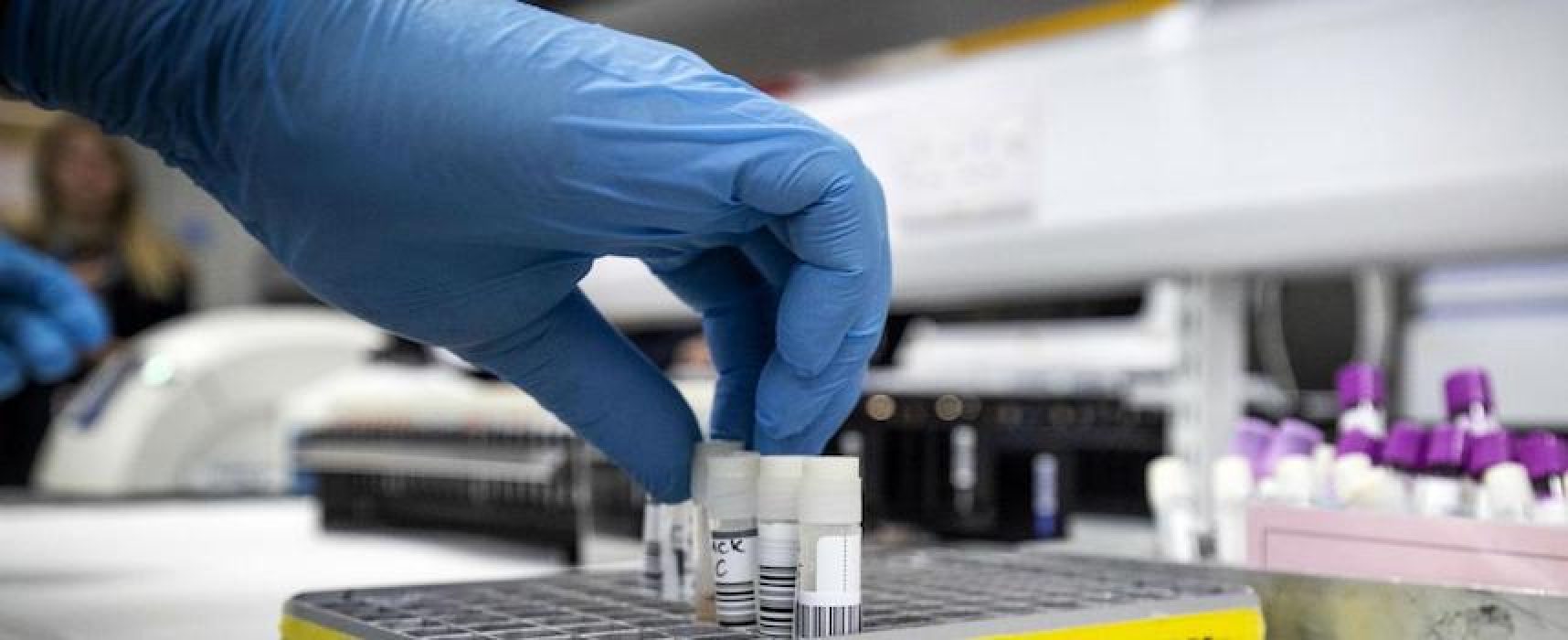 Coronavirus: cala numero test, 1573 i nuovi casi con 3 decessi in Puglia