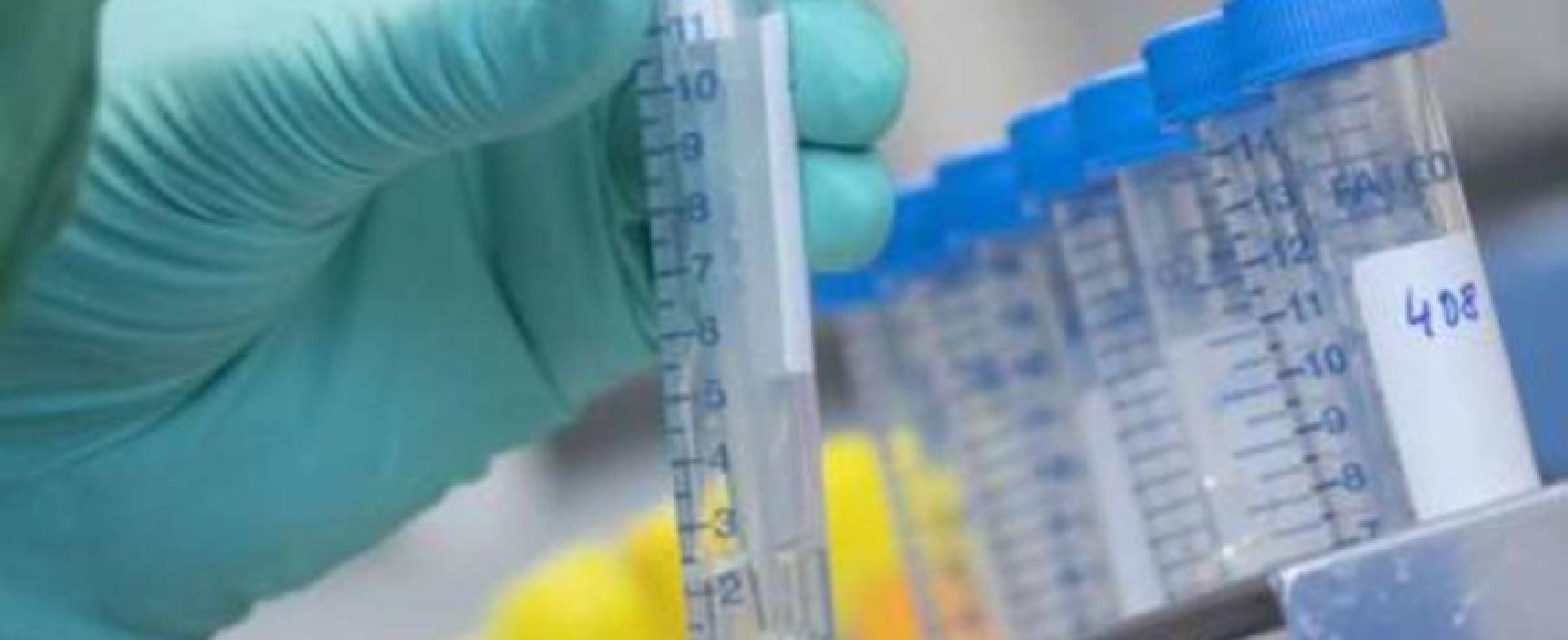 Coronavirus, aggiornamento odierno: 39 nuovi casi e 2 decessi nella Bat