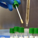 Coronavirus: 2456 nuovi casi in Puglia, -23 ricoveri in reparti ordinari, tornano i decessi