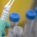 Coronavirus: 7 decessi registrati oggi in Puglia, salgono ricoveri in terapia intensiva