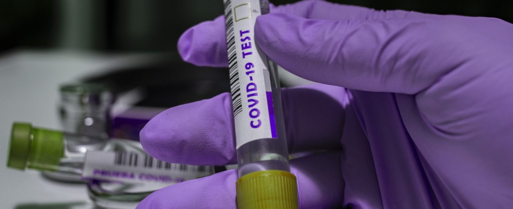Aggiornamento Coronavirus: 608 nuovi casi in Puglia, + 3 ricoveri e nessun decesso registrato