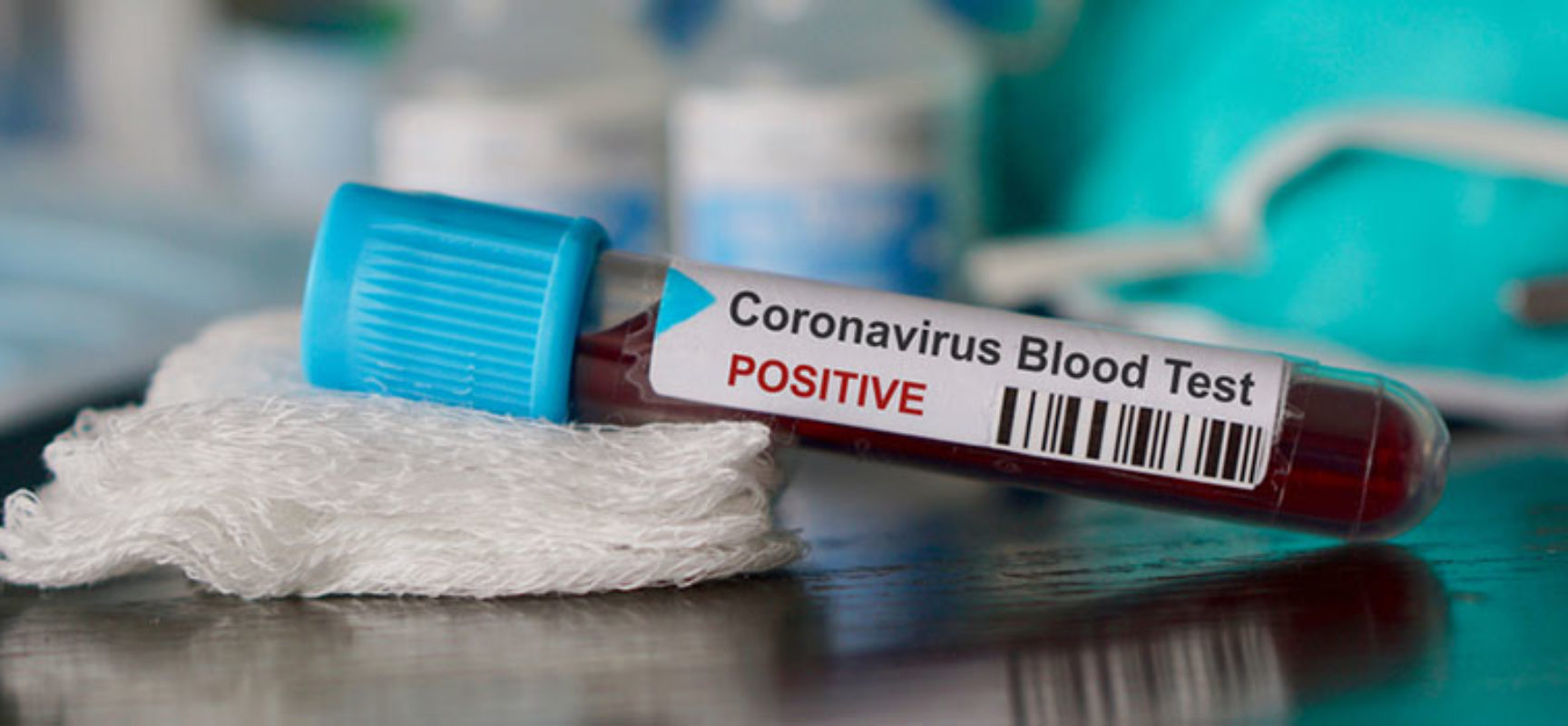 Coronavirus: 1236 i nuovi casi odierni in Puglia, 4 decessi nelle ultime ore