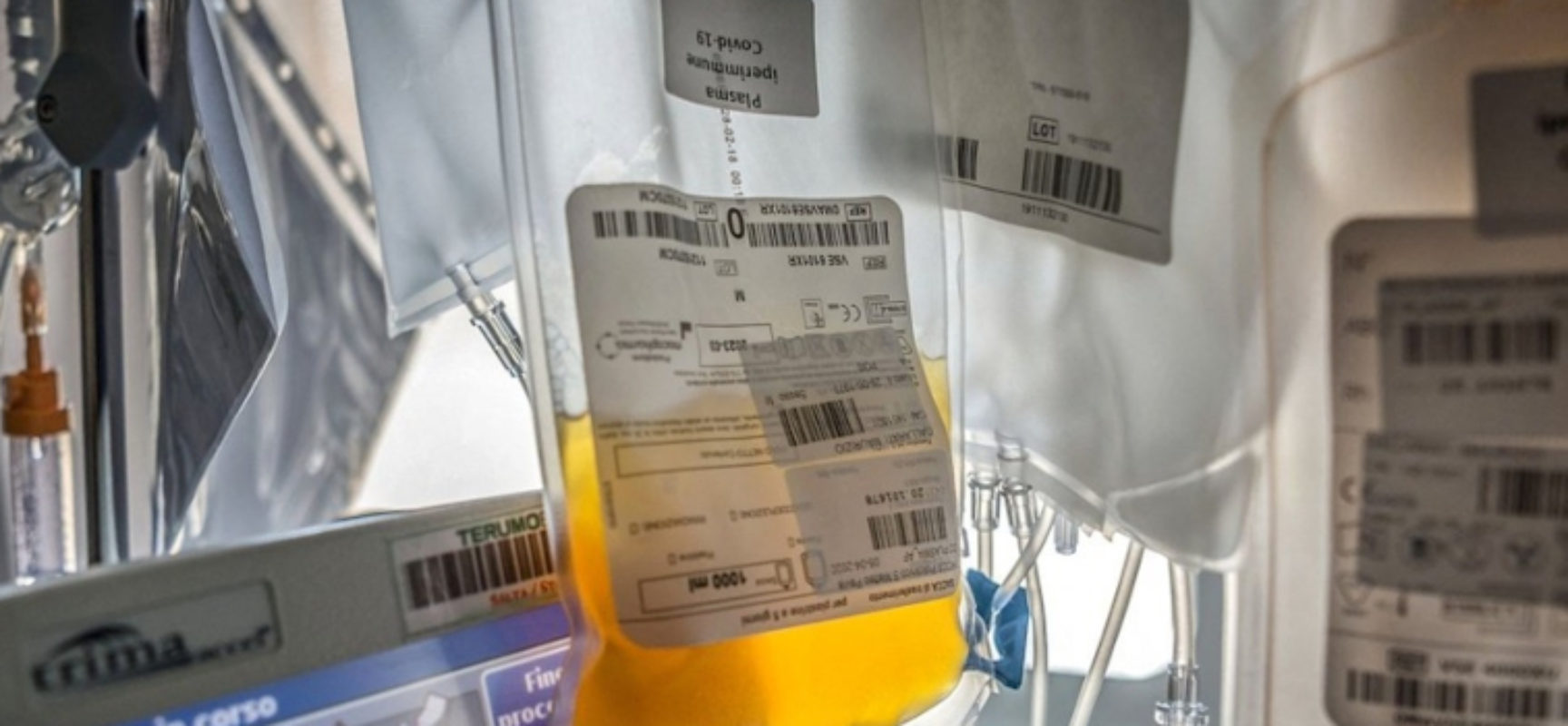 Donazione plasma iperimmune da pazienti guariti anche nell’Asl Bat / CONTATTI